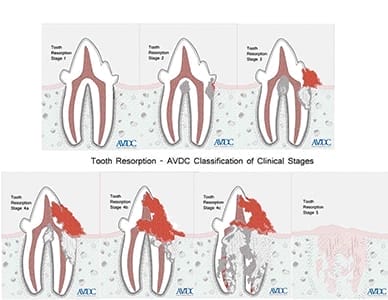 Figure 111